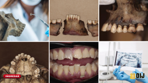 Odontología forense: la especialidad que convierte sonrisas en evidencia